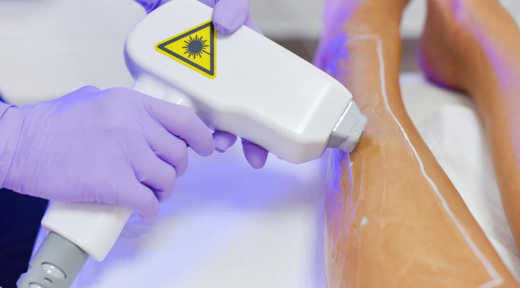 crema para tatuajes con anestesia